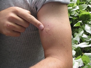 Mosquito Control Melbourne